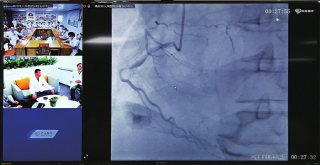 北京高州专家线上术前远程会诊。<br>